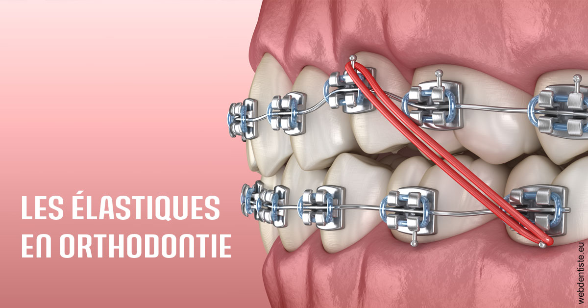 https://www.drbenoitphilippe.com/Elastiques orthodontie 2